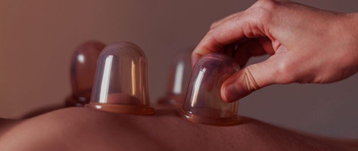 Cupping Masajı